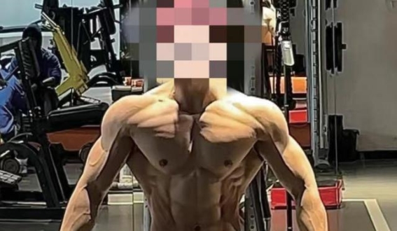 增肌药物滥用背后的法律与监管挑战