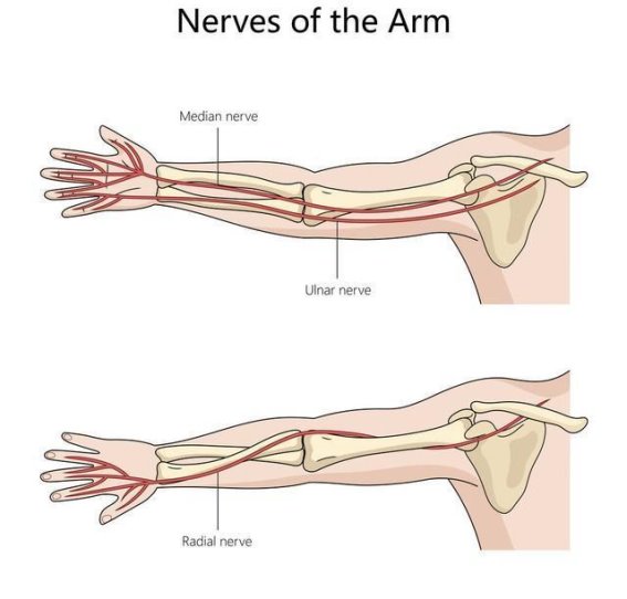 昆明43岁李师傅的求医之旅：工伤致右臂神经损伤，康复路漫长艰辛
