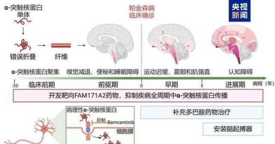 帕金森病治疗迎来革命性突破：中国团队发现全新治疗靶点FAM171A2