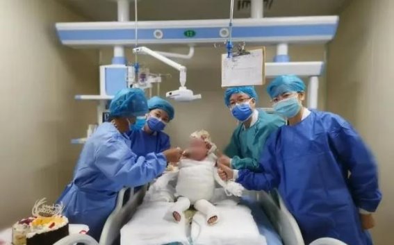 手足显微外科与烧伤患者的心理调适