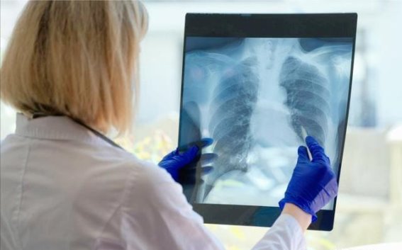 维生素B3或成慢阻肺治疗的新希望：最新研究带来的启示