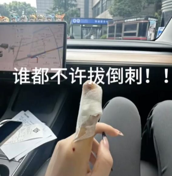 春季皮肤干燥引发倒刺，正确处理避免不良后果