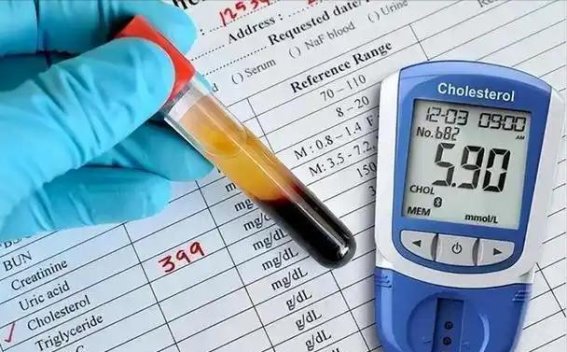 白菜真是血脂的“克星”？医生提醒：血脂高的人可常吃这三种蔬菜