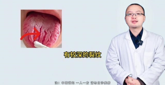 舌头裂纹揭示的健康密码：补肾与健脾的辨证调理