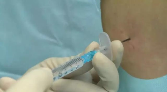 全身麻醉背后的科学与误解