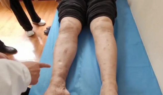 类风湿患者切勿病急乱投医，正确治疗才能走向康复