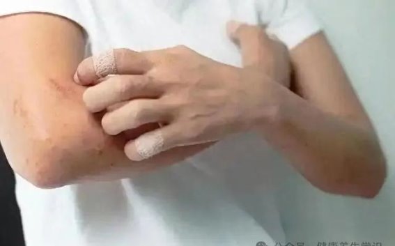 尿毒症的隐秘信号：皮肤变化不可忽视