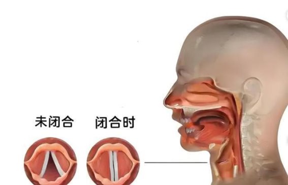 新生儿声带麻痹手术成功，呼吸自由带来生命奇迹