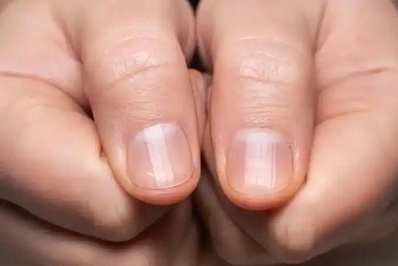 老年人指甲长得快，真能预示长寿吗？医生怎么说