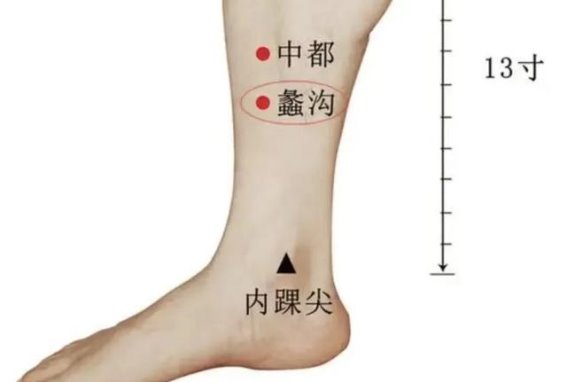 女性外阴瘙痒的中医治疗与针灸方法探讨