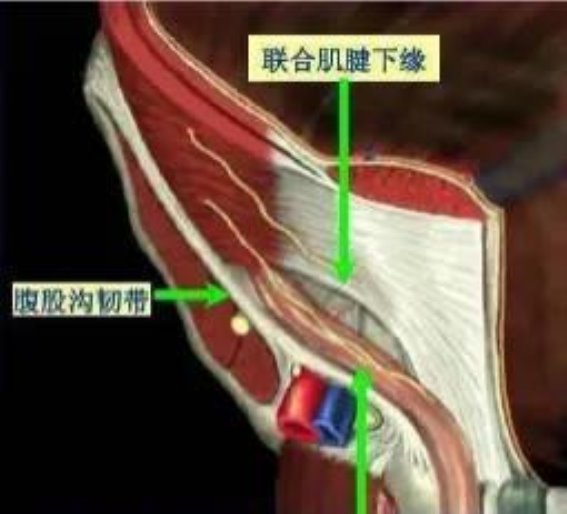 腹股沟韧带解剖与临床意义探讨