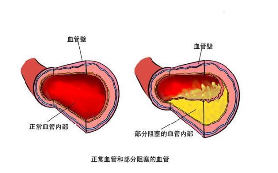 警惕！这些食物可能是你血脂升高的“幕后黑手”
